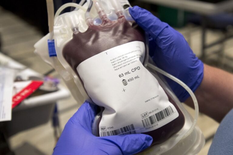 La transfusion sanguine chez les Témoins de Jehovah.